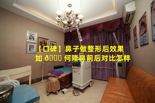 【口碑】鼻子做整形后效果如 🐈 何隆鼻前后对比怎样